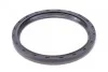 Комплект ланцюга ГРМ BMW 3 (E93/F30)/X3 (F25)/X5 (F15) 06-18 (z=86/70) (N47/B47) FEBI BILSTEIN 102040 (фото 11)