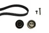 Комплект ГРМ Citroen Berlingo/Jumpy 1.9D (DW8 1868) HEPU 20-1615 (фото 2)