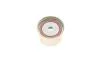 Комплект ГРМ Audi A4/A6/A8 3.0 00-06 (30x281z) HEPU 20-1633 (фото 7)